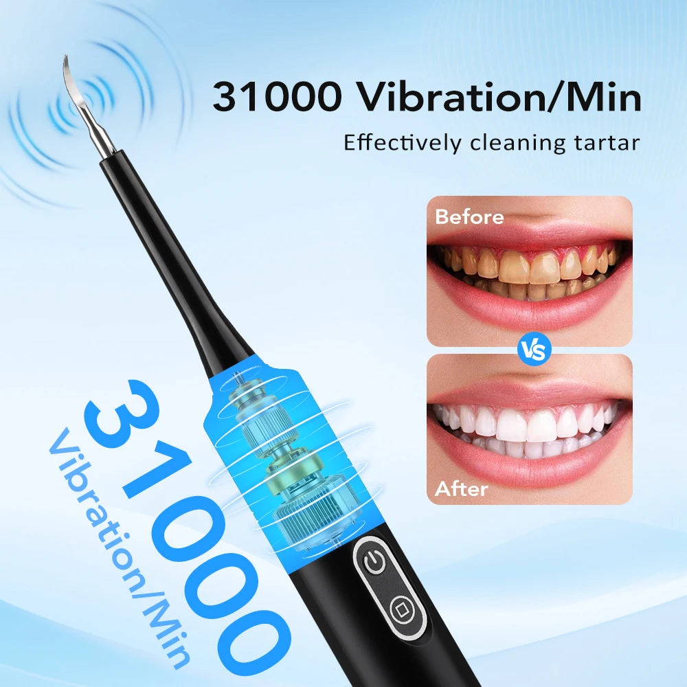 Limpiador Dental Eléctrico