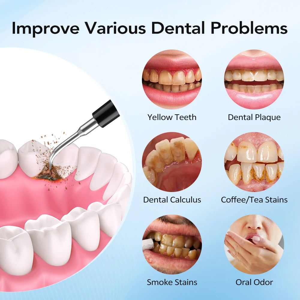 Limpiador Dental Eléctrico